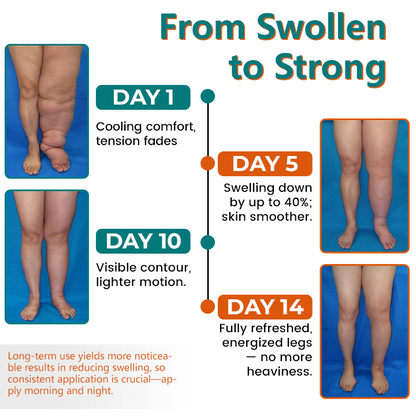 LymphoEase Magnesium Roll-On Relief Cream