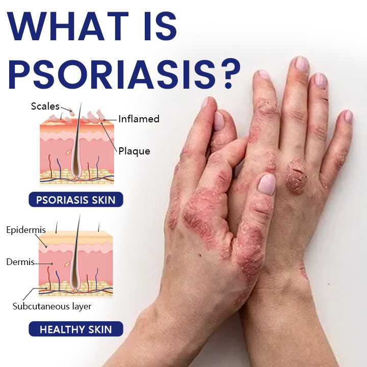 ✅Official Store |  DermaSooth Repair Cream