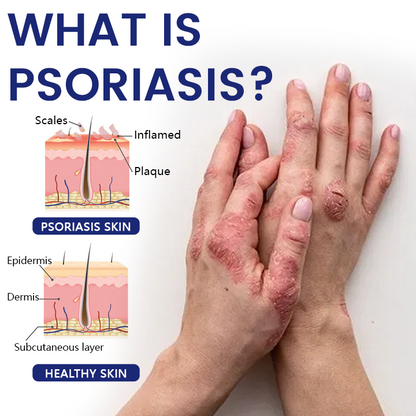 ✅Official Store |  DermaSooth Repair Cream