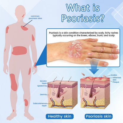 ✅ Official Store: DermaMag Magnesium Repair Spray 🔥 FDA Certified (Clinically Proven Relief for Psoriasis, Eczema, and Chronic Skin Irritation 🌿)