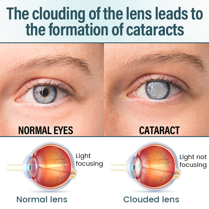 OptiFusion Nano Eye Drops Serum