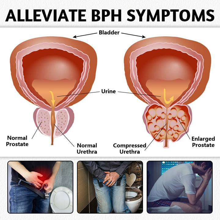 ✨LAST DAY -50% OFF✨ Prostate Health Magnetic Therapy Ring