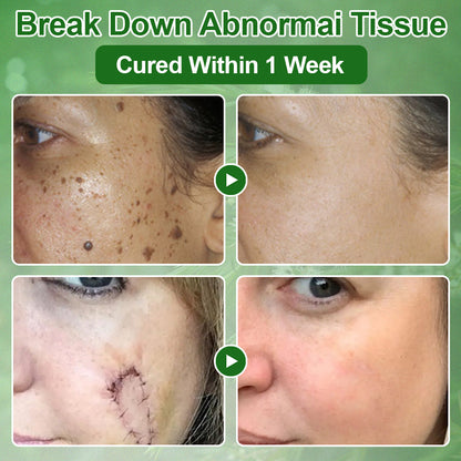 🔥𝐓𝐞𝐚 𝐓𝐫𝐞𝐞 𝐎𝐢𝐥 𝐒𝐤𝐢𝐧 𝐓𝐫𝐞𝐚𝐭𝐦𝐞𝐧𝐭 𝐂𝐫𝐞𝐚𝐦✅𝐅𝐃𝐀-𝐀𝐏𝐏𝐑𝐎𝐕𝐄𝐃 – Removes Skin Blemishes, Repairs Damaged Skin, Brightens & Anti-Ageing Care