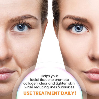 🔥Last Day Promotion 49% OFF - Korean Dermalayr Technology Soluble Collagen Film