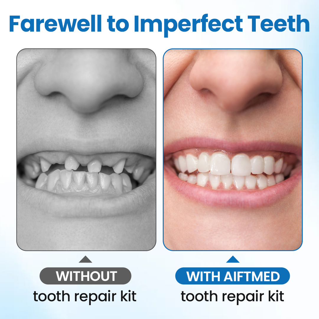 🔥Last day:50% off🔥 SmileMend Tooth Repair Filling Kit