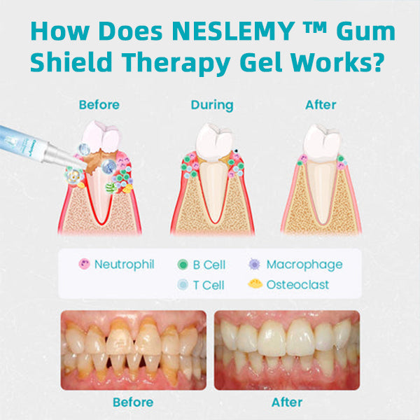 Gum Shield Therapy Gel