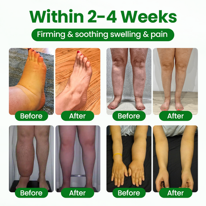 ✅Official Store | VenoLift Leg Relief Spray