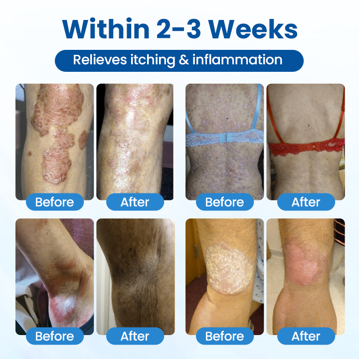 ✅Official Store | PCA Magnesium Deep Repair Spray