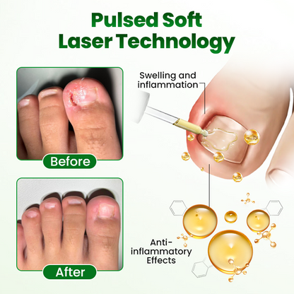 🔥Last day:70% off🔥 HerbaNail 7-Day Repair Serum 🔥 FDA Certified (Clinically Proven Herbal Formula for 7-Day Nail Fungus Repair & Strength Restoration 🌿)