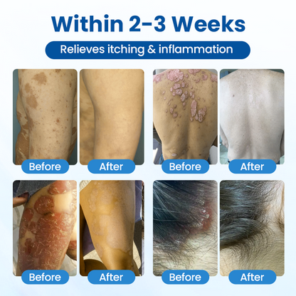 ✅Official Store | PCA Magnesium Deep Repair Spray