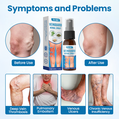 VeinGuard Herbal Spray✅ Clinically proven to eliminate varicose veins in just 7 days!