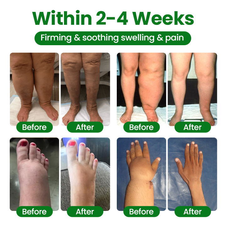 ✅Official Store | VenoLift Leg Relief Spray