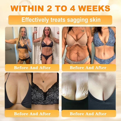 LiftnGlow Bee Venom Skin Firming Cream