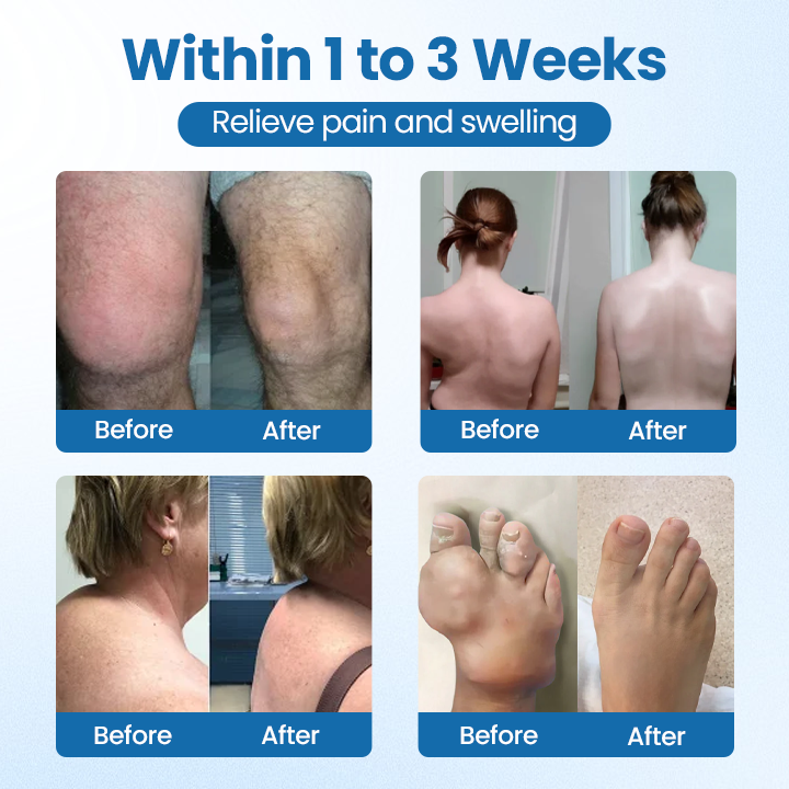 ✅Official Store |  BPC-157 Joint Repair Cream