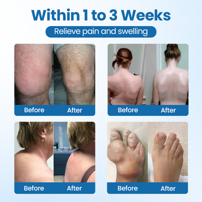 ✅Official Store |  BPC-157 Joint Repair Cream