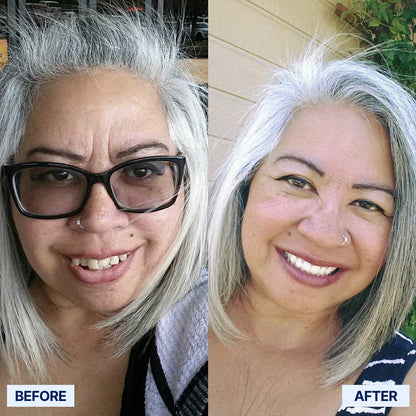 AdaptableFit Functional Dentures – Made in the USA & FDA-Certified