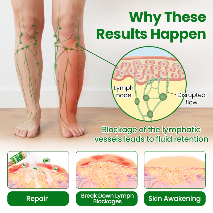 ✅Official Store | VenoLift Leg Relief Spray