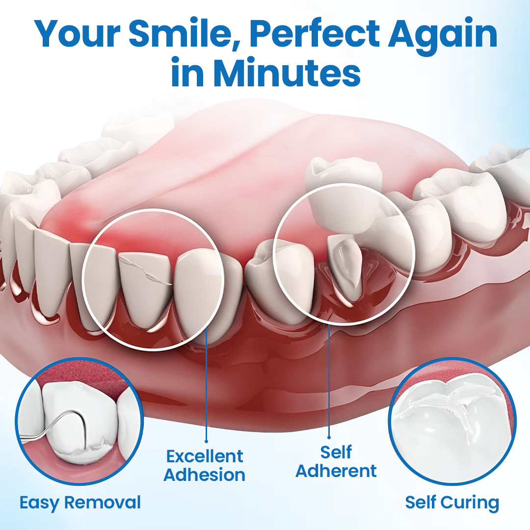 🔥Last day:50% off🔥 SmileMend Tooth Repair Filling Kit