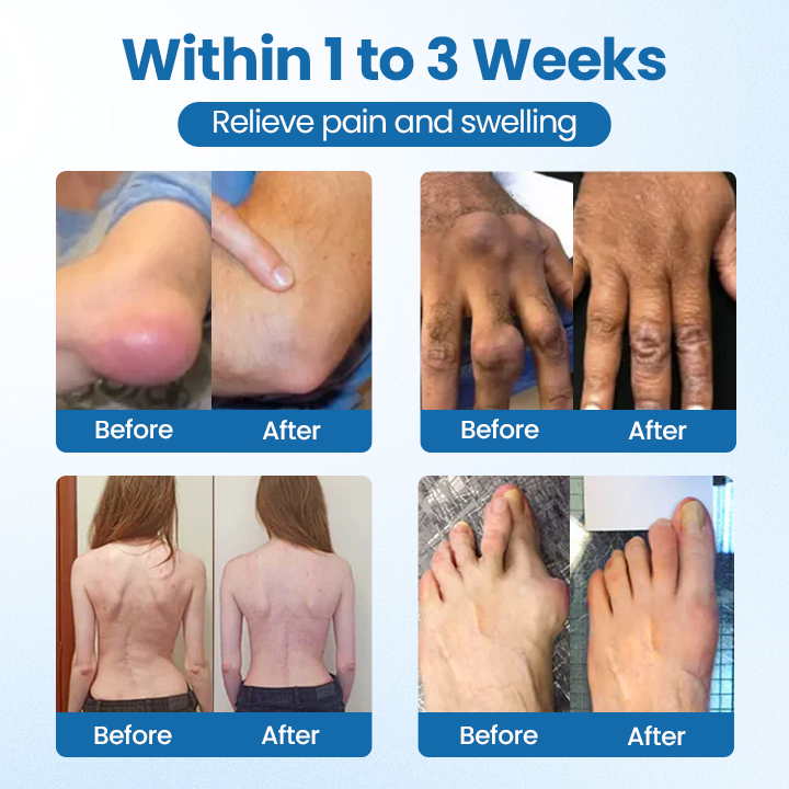 ✅Official Store |  BPC-157 Joint Repair Cream