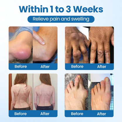 ✅Official Store |  BPC-157 Joint Repair Cream