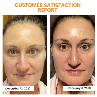 🔥Last Day Promotion 49% OFF - Korean Dermalayr Technology Soluble Collagen Film