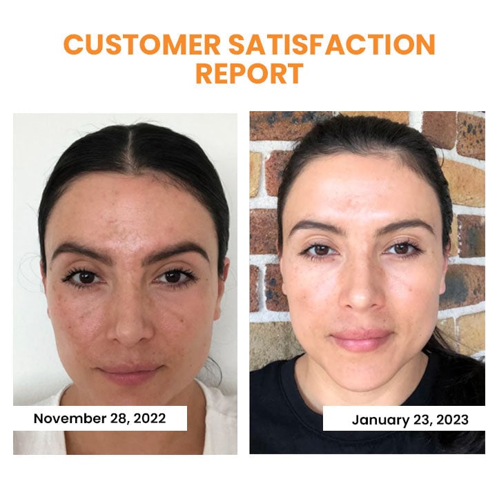 🔥Last Day Promotion 49% OFF - Korean Dermalayr Technology Soluble Collagen Film