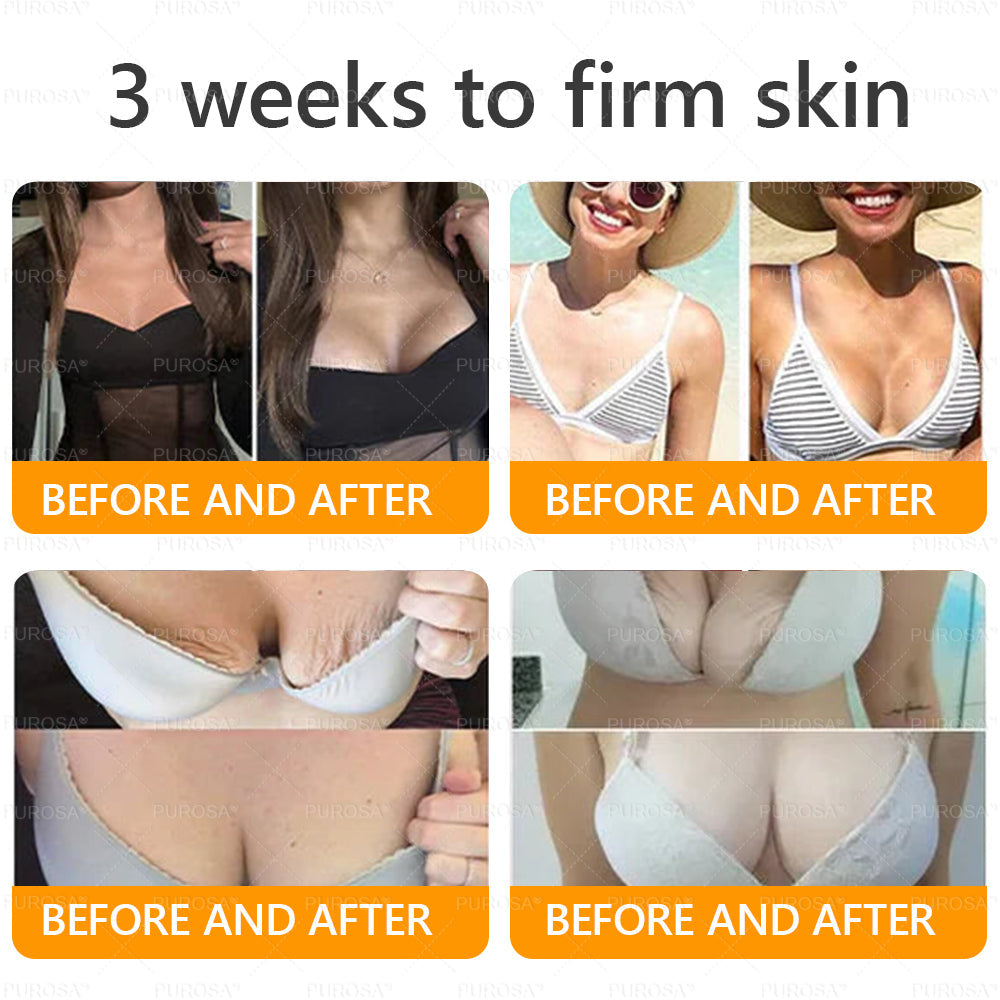 Made and Shipped from USA ✨ 𝐵𝑒𝑒 𝑉𝑒𝑛𝑜𝑚 & 𝑅𝑒𝑡𝑖𝑛𝑜𝑙 𝐶𝑜𝑚𝑝𝑙𝑒𝑥 𝑆𝑘𝑖𝑛 𝑅𝑒𝑠𝑡𝑜𝑟𝑎𝑡𝑖𝑜𝑛 𝐶𝑟𝑒𝑎𝑚🔥 LAST DAY 80% OFF 💎