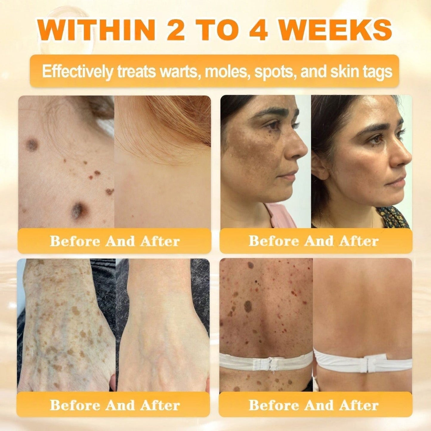 LiftnGlow Bee Venom Skin Firming Cream