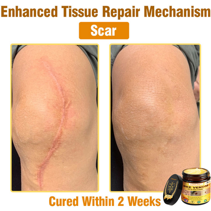 Bee Venom Cream – 🌸 Anti-Aging, Hydrating & Skin Repair