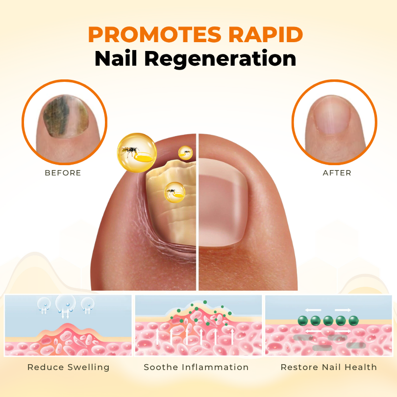 NailRevive Bee Venom Anti-fungi Solution