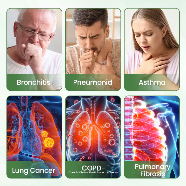 LAST DAY 49%OFF🔥 LungPure Herbal Detox Inhaler