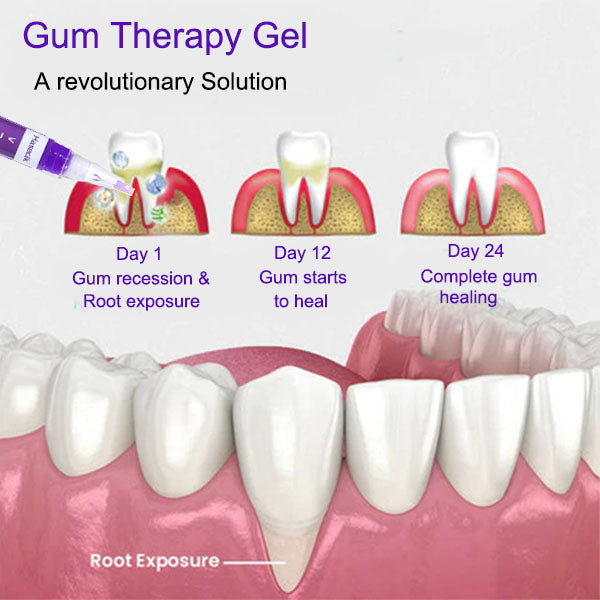 ✨ Teeth Whitening Serum Pen 😁