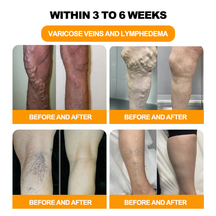 🔥30-Herb Slimming & Detox Foot Bath Beads-🦵👩‍⚕️(LANA Certification, Lymphatic Association of America)