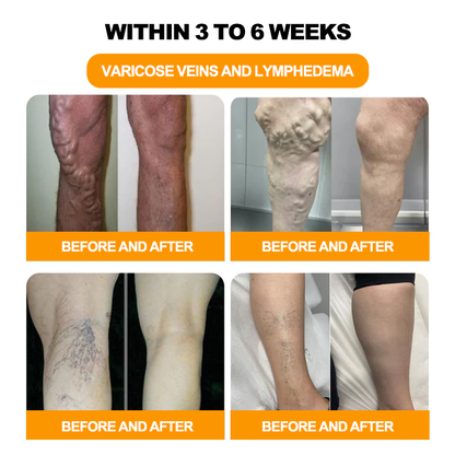 🔥30-Herb Slimming & Detox Foot Bath Beads-🦵👩‍⚕️(LANA Certification, Lymphatic Association of America)