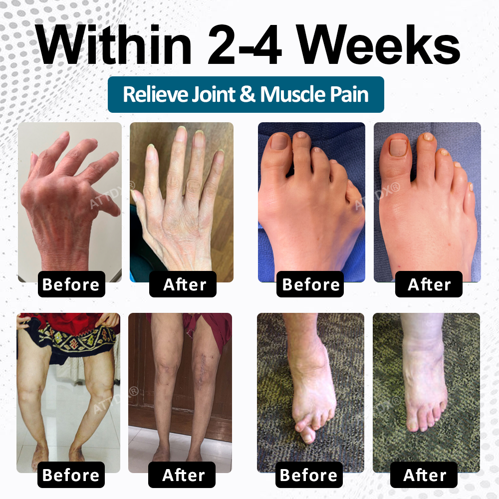 BPC-157 ArthroFlex Motion+ Capsules