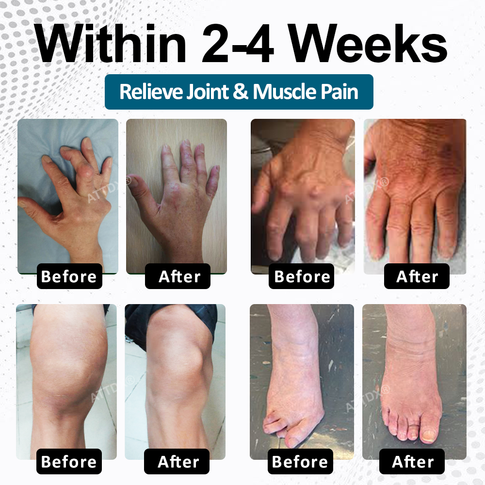 BPC-157 ArthroFlex Motion+ Capsules