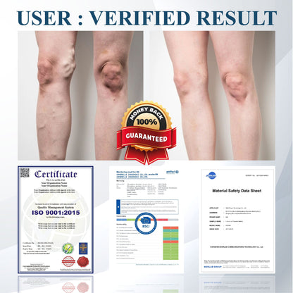 Black Cumin Edema Soothing Herbal Cream -👩‍⚕️Doctor-Endorsed Herbal Formula