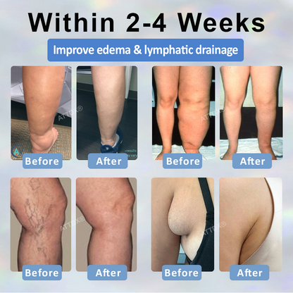 Black Cumin Edema Soothing Herbal Cream -👩‍⚕️Doctor-Endorsed Herbal Formula