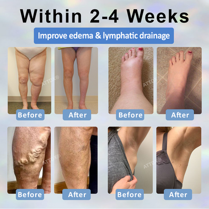 Black Cumin Edema Soothing Herbal Cream -👩‍⚕️Doctor-Endorsed Herbal Formula