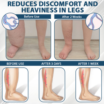 Black Cumin Edema Soothing Herbal Cream -👩‍⚕️Doctor-Endorsed Herbal Formula