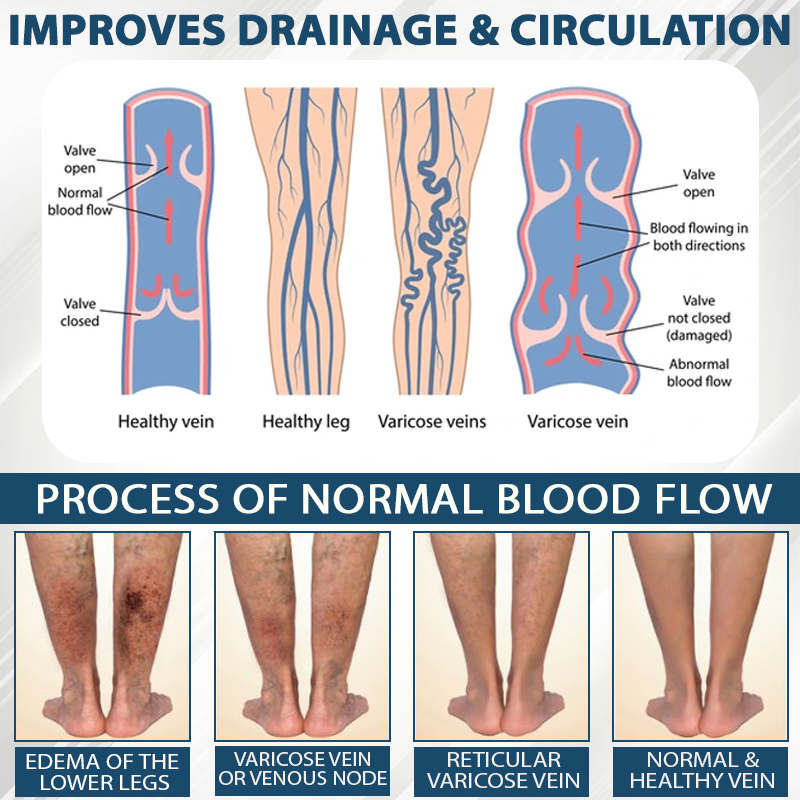 Black Cumin Edema Soothing Herbal Cream -👩‍⚕️Doctor-Endorsed Herbal Formula