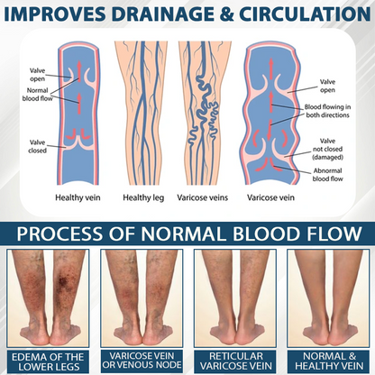 Black Cumin Edema Soothing Herbal Cream -👩‍⚕️Doctor-Endorsed Herbal Formula