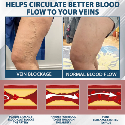 Black Cumin Edema Soothing Herbal Cream -👩‍⚕️Doctor-Endorsed Herbal Formula