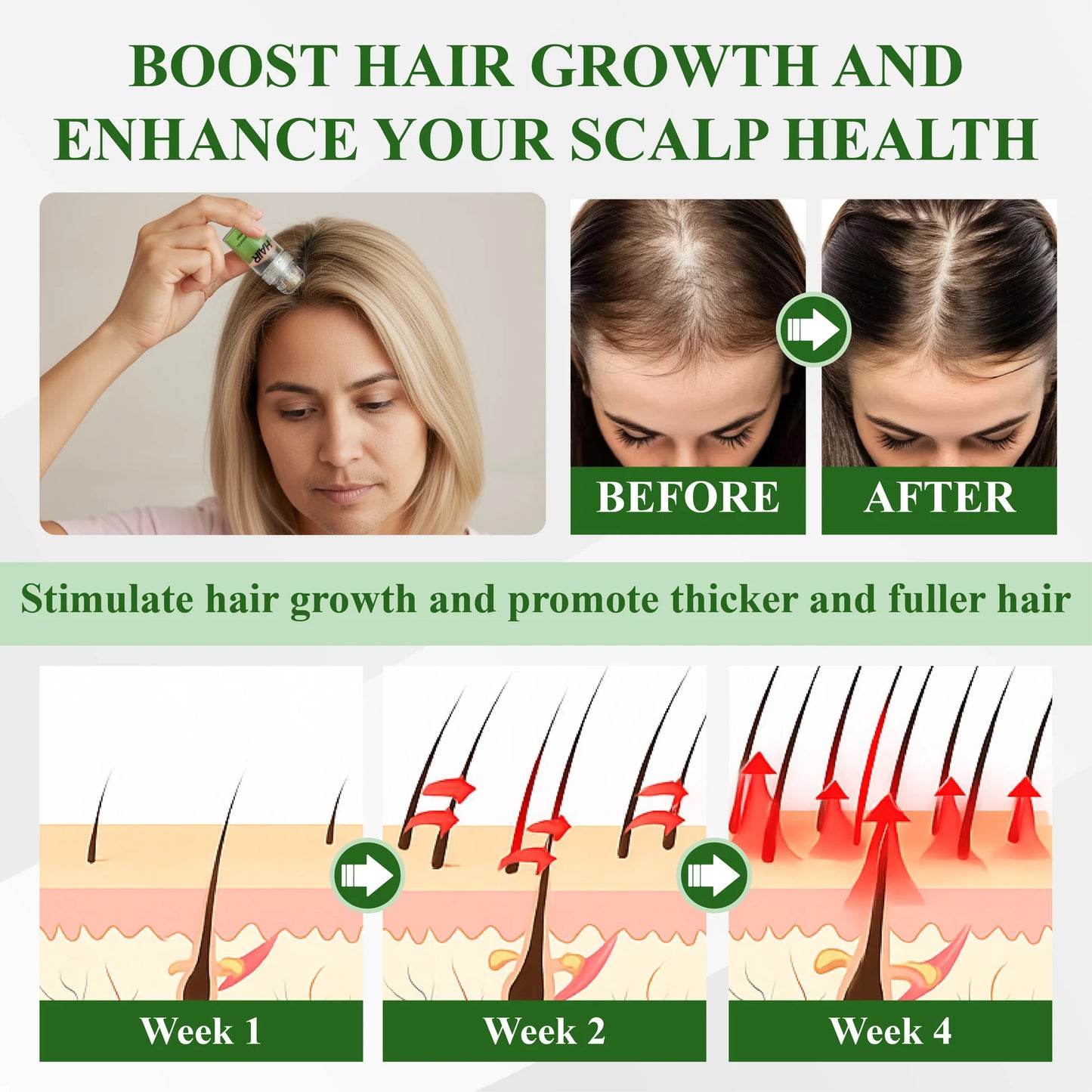 HairFuse Micro-Infusion Hair Regrowth Kit