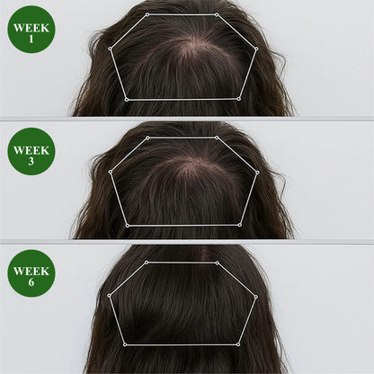 HairFuse Micro-Infusion Hair Regrowth Kit