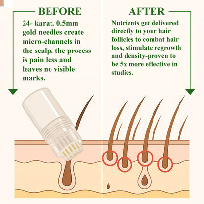 HairFuse Micro-Infusion Hair Regrowth Kit