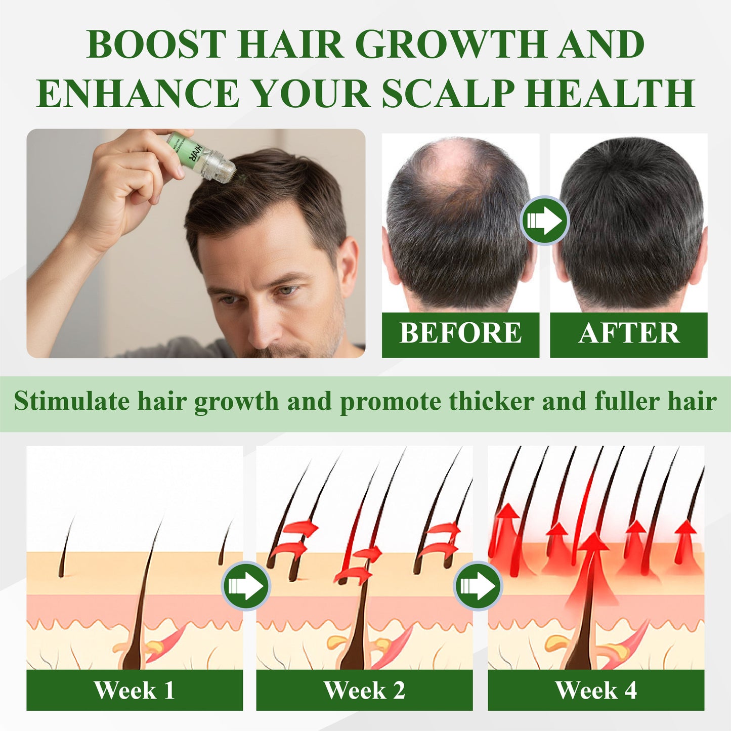 🔥TikTok Hot Sellers- ATTDX® ManGro EGCG Microneedle Scalp Essence Kit