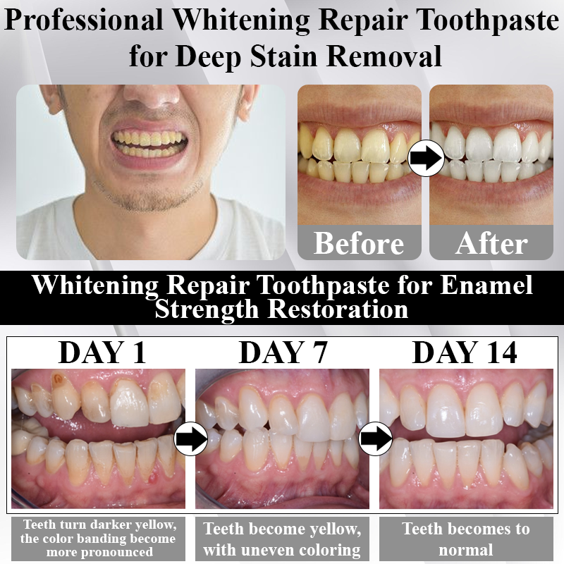 🔥TikTok Hot Sellers- MaxNHA Whitening Repair Toothpaste