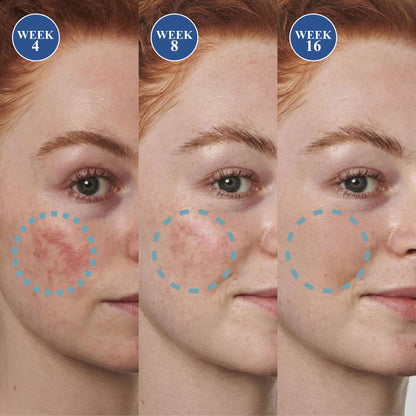 🔥TikTok Hot Sellers- ATTDX® Melano+ 377 Whitening & Spot Cream