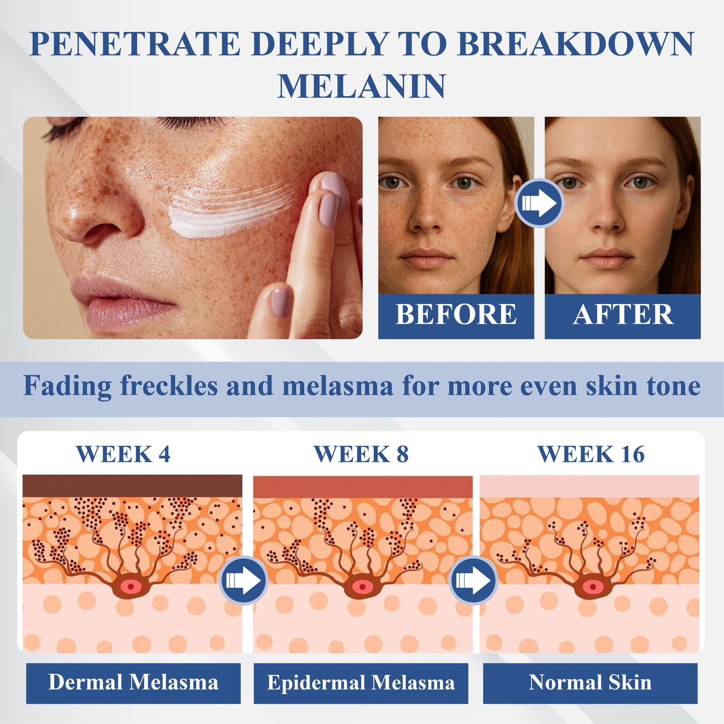 🔥TikTok Hot Sellers- ATTDX® Melano+ 377 Whitening & Spot Cream